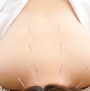 Angel-Hands-Acupuncture-New-Jersey-Healing-Therapy-Back-Pain-Greer-Gartenberg-Cosmetic-Facial-Acupuncture-Cupping-Gua-Sha-New-Jersey-Injury